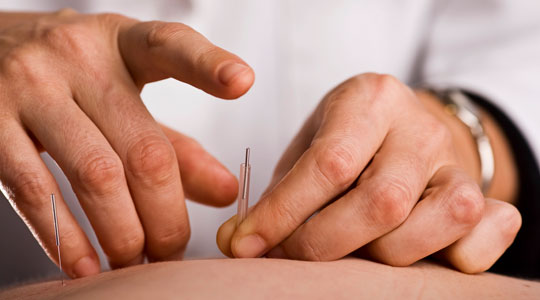Different Types of Acupuncturists - Columbus Acupuncture LLC in Columbus, IN